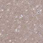 Immunohistochemical staining of human cerebral cortex shows moderate positivity in neuropil.