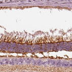 Immunohistochemical staining of human eye shows strong positivity in retina.