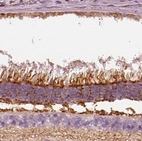 Immunohistochemical staining of human eye shows strong positivity in retina.