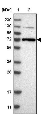 Lane 1: Marker [kDa] 230, 130, 95, 72, 56, 36, 28, 17, 11_br/_Lane 2: Human cell line RT-4