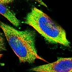 Immunofluorescent staining of human cell line U-251 MG shows localization to plasma membrane & cytosol.