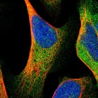 Immunofluorescent staining of human cell line U-2 OS shows localization to cytosol.