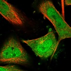 Immunofluorescent staining of human cell line U-251 MG shows localization to nucleoplasm & cytosol.