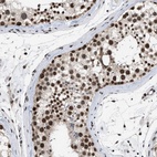 Immunohistochemical staining of human testis shows high expression.