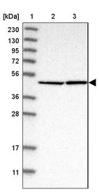 Lane 1: Marker [kDa] 230, 130, 95, 72, 56, 36, 28, 17, 11_br/_Lane 2: Human cell line RT-4_br/_Lane 3: Human cell line U-251MG sp