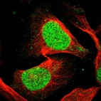 Immunofluorescent staining of human cell line U-2 OS shows localization to nucleoplasm.