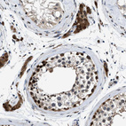 Immunohistochemical staining of human testis shows strong cytoplasmic positivity in Leydig cells.