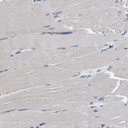 Immunohistochemical staining of human skeletal muscle shows no positivity in myocytes as expected.