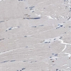 Immunohistochemical staining of human skeletal muscle shows no positivity in myocytes as expected.