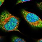 Immunofluorescent staining of human cell line U-2 OS shows localization to nucleoplasm & cytosol.