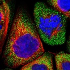 Immunofluorescent staining of human cell line A-431 shows localization to cytosol.