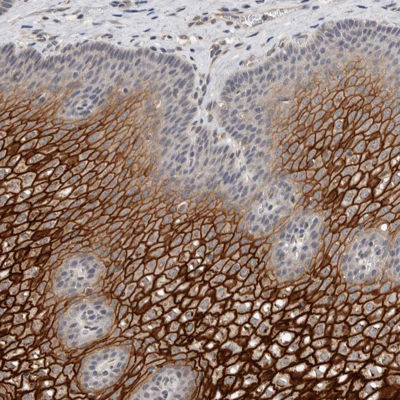 Anti-CYSRT1 Antibody
