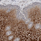 Anti-CYSRT1 Antibody