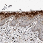 Immunohistochemical staining of human skin shows strong membranous positivity in squamous epithelial cells.