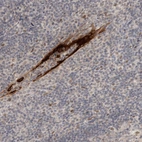 Immunohistochemical staining of human tonsil shows strong membranous positivity in squamous epithelial cells.