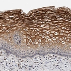 Immunohistochemical staining of human cervix shows strong membranous positivity in squamous epithelial cells.