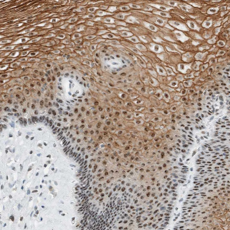 Anti-CYSRT1 Antibody