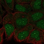 Immunofluorescent staining of human cell line RT4 shows localization to nucleoplasm, nucleoli fibrillar center & cytosol.