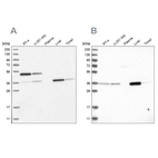 Western blot analysis using Anti-CRYZ antibody HPA021921 (A) shows similar pattern to independent antibody HPA023290 (B).