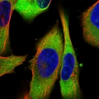 Immunofluorescent staining of human cell line U-251 MG shows localization to cytosol.