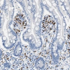 Immunohistochemical staining of human small intestine shows moderate to strong membranous positivity in lymphoid cells.