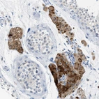 Immunohistochemical staining of human testis shows moderate to strong cytoplasmic positivity in Leydig cells.