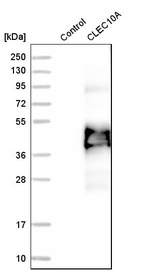 Anti-CLEC10A Antibody