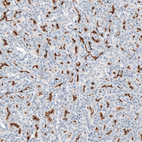 Anti-CFTR Antibody