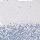 Immunohistochemical staining of human cerebellum shows no positivity in Purkinje cells as expected.