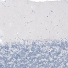 Immunohistochemical staining of human cerebellum shows no positivity in Purkinje cells as expected.