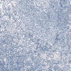Immunohistochemical staining of human lymph node shows no positivity in non-germinal center cells as expected.