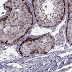 Anti-MAGEA4 Antibody