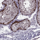 Immunohistochemical staining of human testis shows strong nuclear and cytoplasmic positivity in cells in seminiferous ducts.