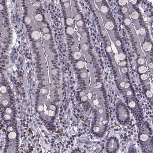 Anti-MAGEA4 Antibody