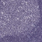 Immunohistochemical staining of human tonsil shows no positivity in lymphoid cells as expected.