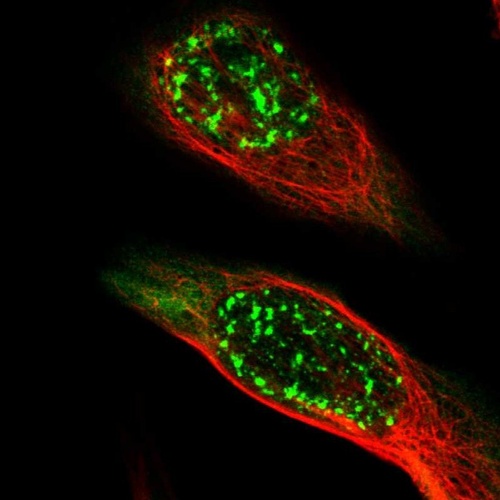 Anti-MAGEA4 Antibody