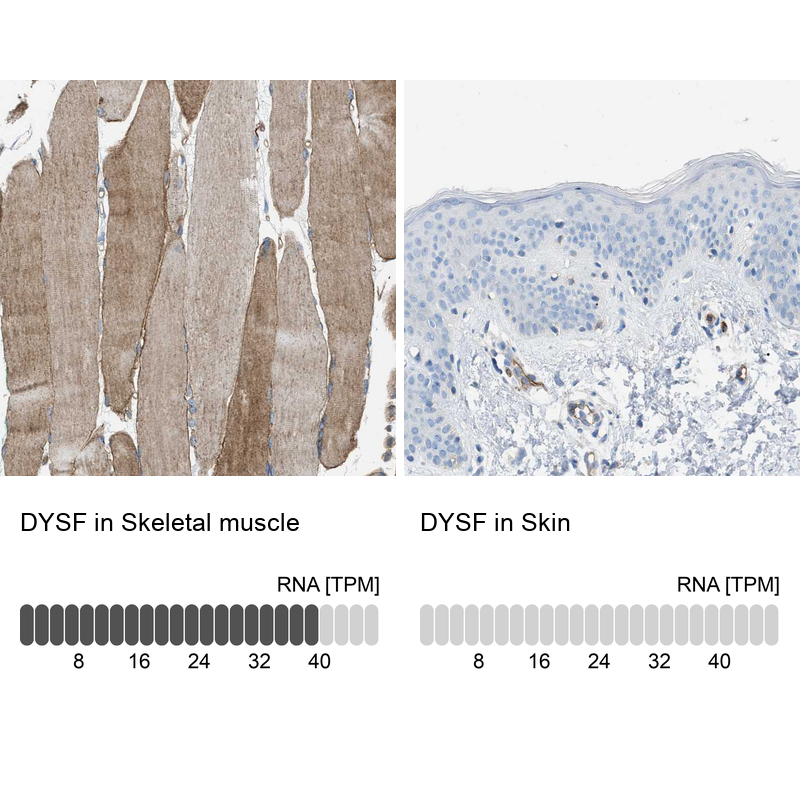 Anti-DYSF Antibody