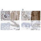 Immunohistochemical staining of human kidney, skeletal muscle, skin and testis using Anti-DYSF antibody HPA021945 (A) shows similar protein distribution across tissues to independent antibody HPA017071 (B).