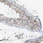 Immunohistochemical staining of human testis shows moderate membranous positivity in cells in seminiferous ducts.