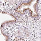 Immunohistochemical staining of human gallbladder shows positivity in glandular cells.