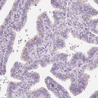 Anti-CHST4 Antibody