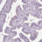 Immunohistochemical staining of human fallopian tube shows positivity in glandular cells.