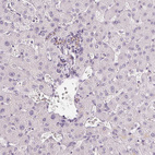 Immunohistochemical staining of human liver shows positivity in bile duct cells.