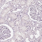 Immunohistochemical staining of human kidney shows no positivity as expected.