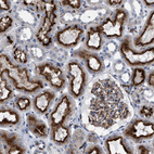 Anti-SLC47A1 Antibody