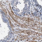 Immunohistochemical staining of human prostate shows moderate cytoplasmic positivity in smooth muscle cells.