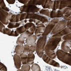Immunohistochemical staining of human skeletal muscle shows strong cytoplasmic positivity in myocytes.