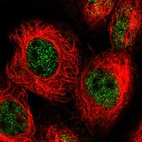 Immunofluorescent staining of human cell line A-431 shows localization to nucleoplasm.