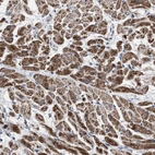Immunohistochemical staining of human heart muscle shows strong granular cytoplasmic positivity in cardiomyocytes.