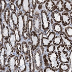 Immunohistochemical staining of human kidney shows strong granular cytoplasmic positivity in cells in tubules.